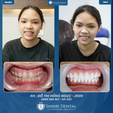 Khách hàng Đỗ Thị Hồng Ngọc